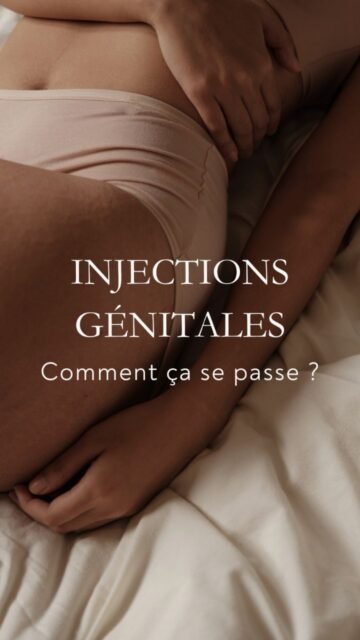 Les injections génitales suscitent souvent une crainte liée à la douleur, alors que le protocole est précisément pensé pour le confort.
Les injections génitales médicales se réalisent toujours sous anesthésie locale afin de garantir une prise en charge indolore.
Une crème anesthésiante fortement dosée en lidocaïne est d’abord appliquée, puis complétée par des injections d’anesthésiant sur l’ensemble de la zone traitée.
Les injections peuvent concerner la fourchette vulvaire, l’entrée du vagin ou les grandes lèvres, à visée fonctionnelle ou volumatrice, avec de l’acide hyaluronique ou du PRP.
La durée du geste est en moyenne de 30 à 40 minutes, dans un cadre médical strict.
Ce contenu montre qu’un protocole bien conduit rend ces injections nettement moins inconfortables qu’un examen gynécologique classique, avec des suites simples et transitoires.
Les injections génitales, lorsqu’elles sont correctement réalisées, sont des gestes médicaux sécurisés visant à améliorer le confort intime.
#injectionsgenitales
#gynecologieesthetique
#acidehyaluroniqueintime
#santéintime
#medecineesthetique