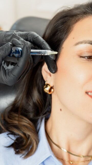 Les tempes creuses vieillissent le visage plus qu’on ne l’imagine.
Avec le temps, la fonte et la descente des compartiments graisseux au niveau des tempes entraînent un aspect plus émacié et squelettisé du visage.
Ce creusement est l’un des premiers signes du vieillissement facial, souvent méconnu car peu visible isolément.
Les injections d’acide hyaluronique au niveau des tempes permettent de restaurer les volumes de soutien, sans alourdir ni transformer les traits.
Cette zone joue un rôle clé dans l’équilibre global du visage et l’harmonie du tiers supérieur.
Ce type de correction apporte un rajeunissement discret, améliore la continuité des volumes et contribue à ouvrir le regard, avec un rendu naturel.
Le traitement des tempes creuses est une approche subtile et efficace pour rajeunir le visage tout en respectant son identité.
#tempescreuses
#acidehyaluronique
#rajeunissementfacial
#harmonisationfaciale