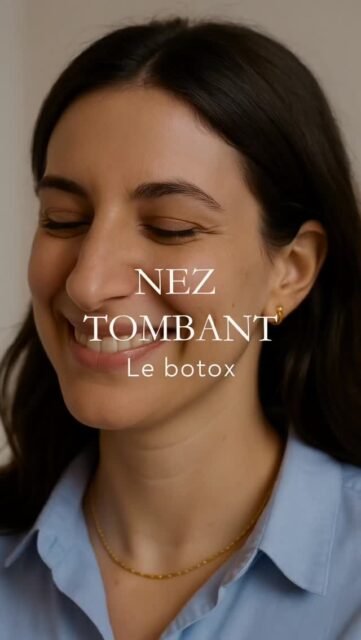 Un nez qui tombe au sourire n’est pas une fatalité.
Chez certaines personnes, la pointe du nez s’abaisse au moment du sourire ou lors de la parole en raison de l’action d’un muscle spécifique : le muscle dépresseur de la pointe du nez (depressor septi nasi).
Les injections de toxine botulique permettent de relâcher ce muscle responsable de la traction vers le bas.
En ciblant précisément cette zone, le Botox limite la contraction musculaire excessive et stabilise la position de la pointe du nez lors des expressions.
Il s’agit d’un geste médical simple, précis et non chirurgical, intégré dans une approche fonctionnelle et esthétique du visage.
Ce traitement améliore la dynamique du sourire et de la parole, en conservant un nez plus stable et plus harmonieux dans l’expression, sans modifier sa structure.
Le Botox du nez est une solution ciblée pour corriger une chute dynamique de la pointe nasale liée au mouvement.
#botoxnez
#poniteduneztombante
#harmonisationfaciale
#sourire
#medecineesthetique