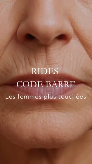 Les rides au-dessus de la bouche ne sont pas une fatalité liée à l’âge, mais à l’anatomie.

Les femmes présentent plus fréquemment des rides péribuccales que les hommes en raison de différences anatomiques et cutanées.
Chez l’homme, la pilosité entraîne une peau plus épaisse et plus riche en collagène, ce qui limite la formation de ces rides.
Chez la femme, la peau est plus fine et le muscle orbiculaire de la bouche est fortement sollicité lors de la parole et des expressions, favorisant l’apparition de rides verticales.
La prise en charge repose sur une approche combinée, agissant à la fois sur l’activité musculaire et sur la stimulation ou la restauration du collagène.

Ce contenu explique pourquoi ces rides apparaissent préférentiellement chez les femmes et met en lumière l’intérêt d’un traitement ciblé, adapté à la physiologie de la zone.

Comprendre l’origine anatomique des rides péribuccales permet une correction plus précise et plus naturelle.

#ridesperibuccales
#ridecodebarre
#qualitedepeau
#medecineesthetique
#harmonisationfaciale