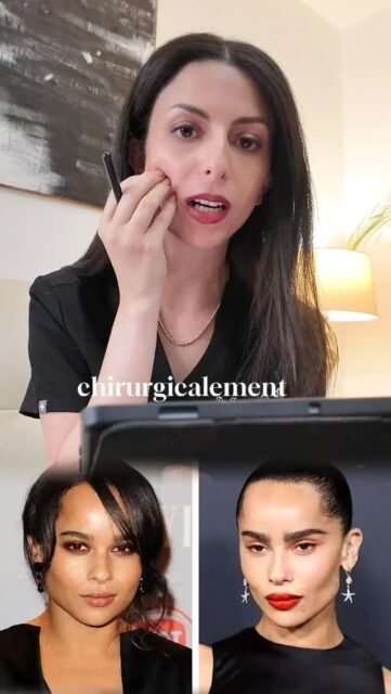 Transformation Zoé Kravitz par la chirurgie et la médecine esthétique