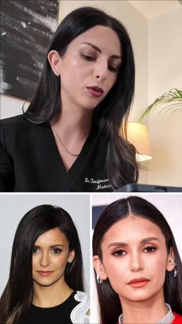 Transformation Nina Dobrev par la chirurgie et la médecine esthétique