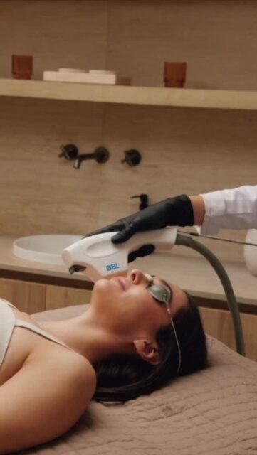 ✨ Peeling, IPL ou laser : quel traitement choisir pour les taches pigmentaires ?
Les taches pigmentaires ne se traitent pas toutes de la même façon. Avant de choisir une technique, il faut identifier le type de tache, sa profondeur et votre phototype.
🔹 Le peeling dépigmentant agit en surface. Il permet d'éclaircir le mélasma, les taches diffuses et d'unifier le teint progressivement.
🔹 L'IPL (Lumière Pulsée Intense) cible les taches solaires et les lentigos. La lumière est absorbée par le pigment qui s'assombrit puis disparaît progressivement.
🔹 Le laser pigmentaire est généralement réservé aux taches plus profondes ou plus résistantes. Il fragmente le pigment de manière très ciblée pour obtenir un éclaircissement plus important.
Chaque technique possède ses indications, ses limites et ses précautions. Le meilleur traitement n'est pas forcément le plus puissant, mais celui qui est adapté à votre peau et à votre type de pigmentation.
L'objectif n'est pas seulement d'effacer les taches existantes, mais aussi de prévenir leur réapparition grâce à une prise en charge globale.
#TachesPigmentaires #PeelingVisage #LaserPigmentaire #IPL #MédecineEsthétique