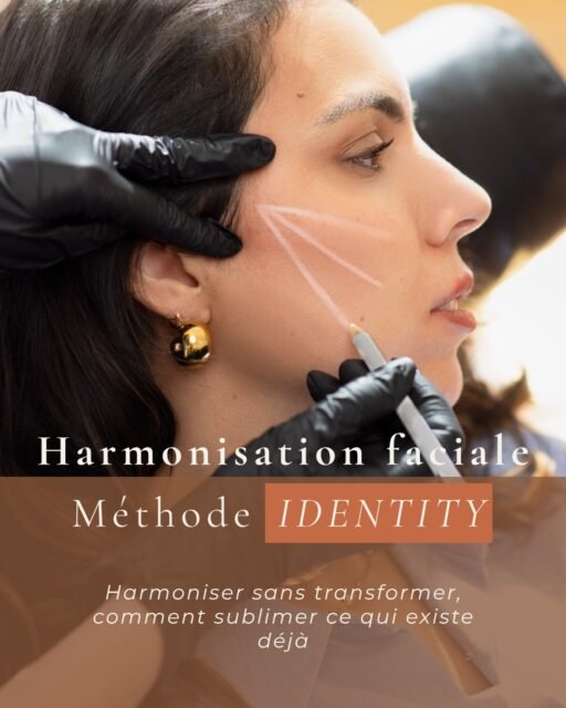 ✨ IDENTITY™ : harmoniser sans standardiser
Pendant longtemps, la médecine esthétique a été guidée par des tendances, des ratios universels ou des modèles de beauté standardisés.
Mais un visage n'est pas une formule mathématique.
Chaque visage possède sa propre architecture, son histoire, ses expressions, ses variations anatomiques et ethniques. Ce qui crée l'harmonie chez une personne peut créer une rupture chez une autre.
C'est de cette réflexion qu'est née la méthode IDENTITY™.
Une approche d'harmonisation faciale fondée sur l'analyse globale du visage :
▫️ Proportions et équilibres
▫️ Variations anthropométriques
▫️ Origines ethniques
▫️ Dynamique musculaire
▫️ Qualité de peau
▫️ Perception du visage dans son ensemble
L'objectif n'est pas de transformer un visage.
L'objectif est de préserver ce qui le rend unique tout en corrigeant ce qui rompt son harmonie.
Parce qu'un visage ne doit pas ressembler à un idéal standardisé.
Il doit rester le vôtre.
IDENTITY™ repose sur un principe simple : Révéler. Harmoniser. Préserver.
#HarmonisationFaciale #IdentityMethod #MédecineEsthétique #AnthropométrieFaciale #BeautéNaturelle