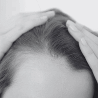 CHEVEUX FINS