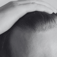 CHEVEUX FINS