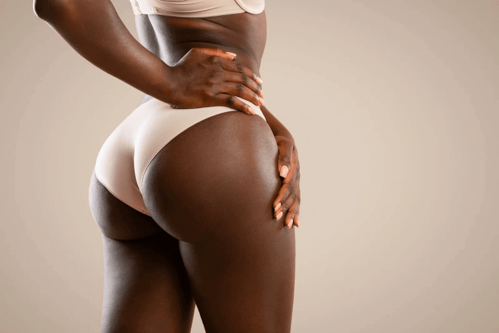 Sculptra fesses - femme