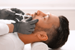 Injection du visage chez un homme pour masculinisation faciale avec acide hyaluronique.