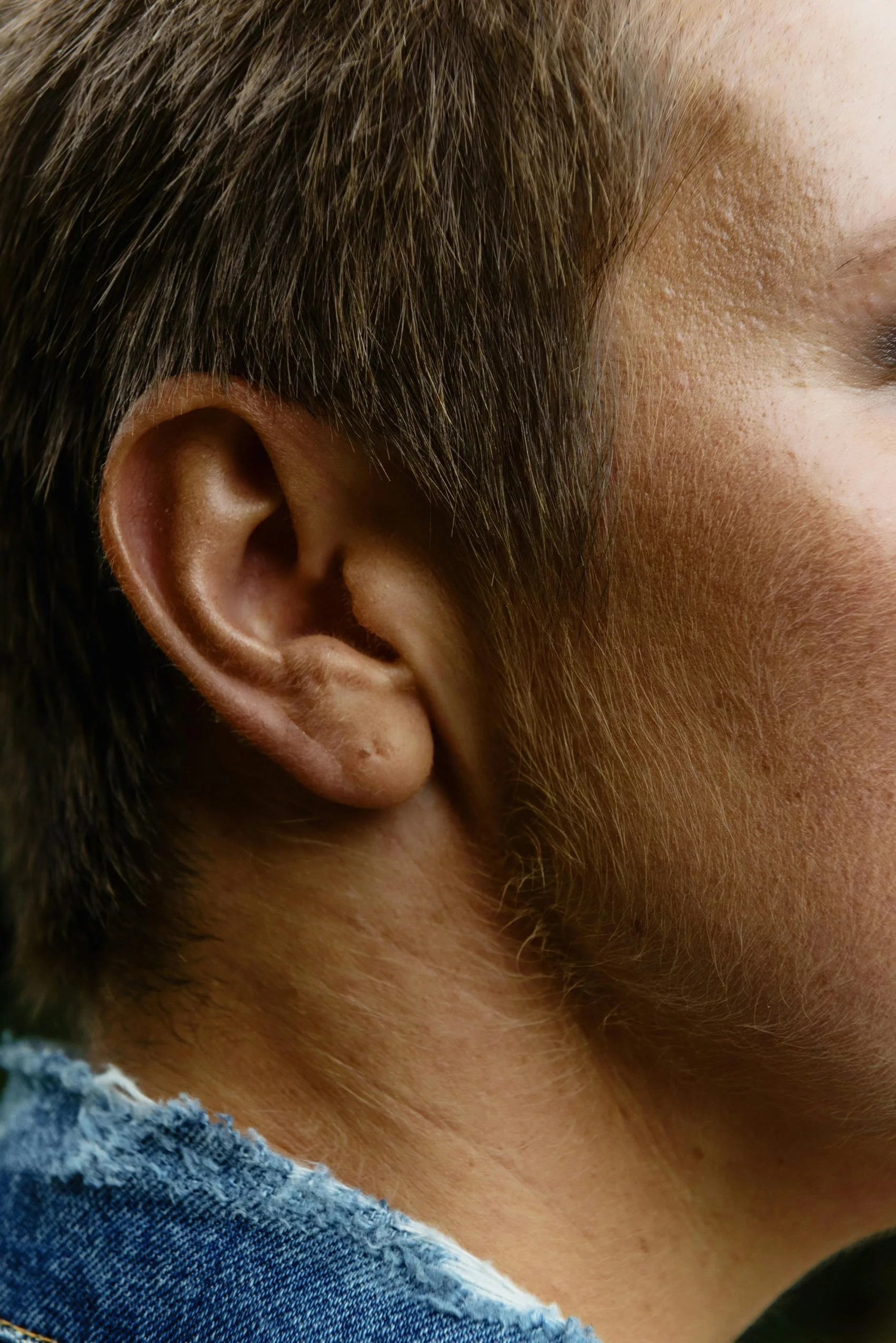 LOBE D’OREILLE