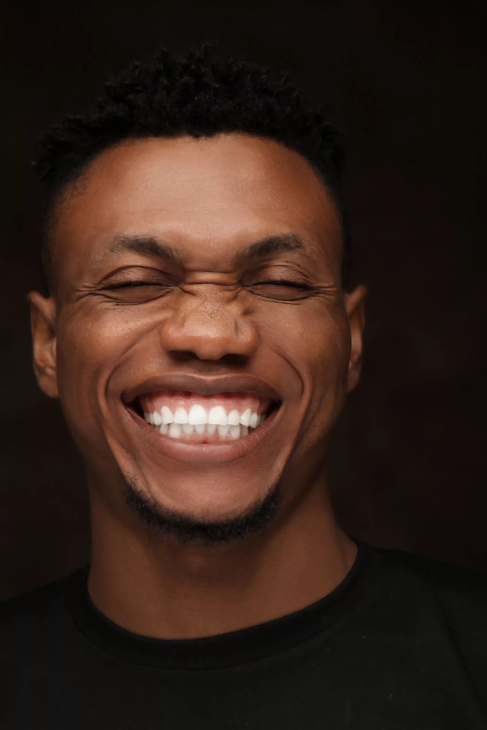 SOURIRE GINGIVAL