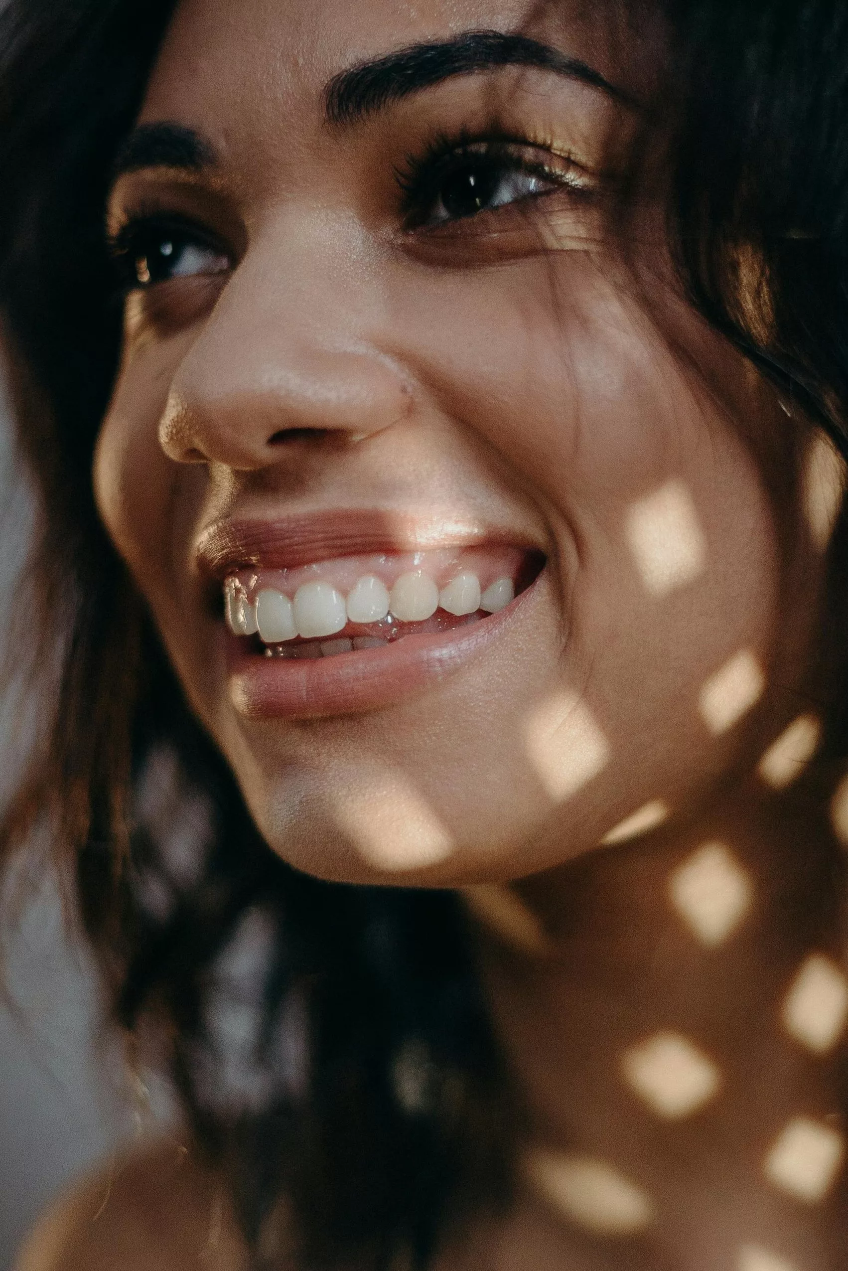 SOURIRE GINGIVAL